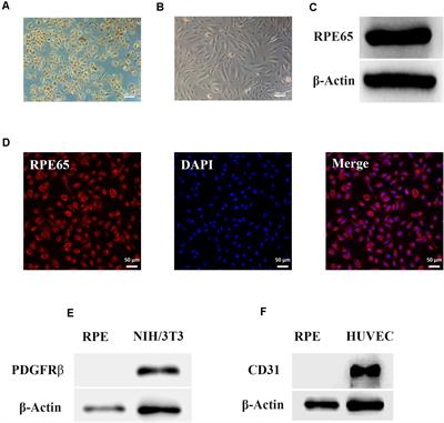 Reversed Senescence of Retinal Pigment Epithelial Cell by Coculture With Embryonic Stem Cell via the TGFβ and PI3K Pathways